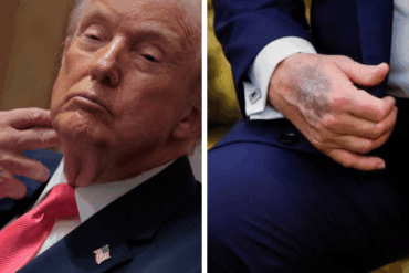 Trump ignora consejos médicos y toma más aspirina