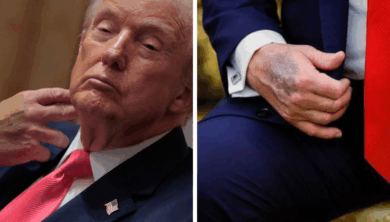 Trump ignora consejos médicos y toma más aspirina