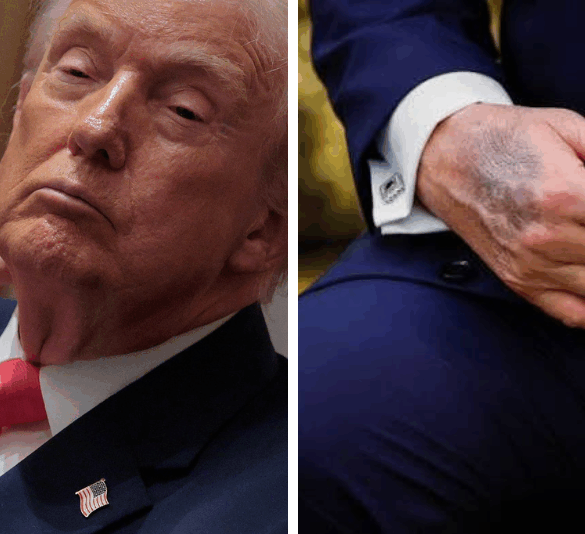 Trump ignora consejos médicos y toma más aspirina